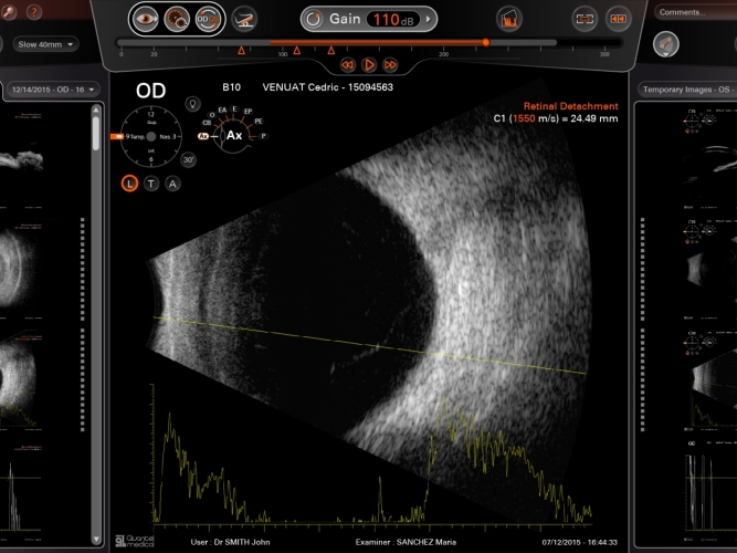 QUANTEL MEDICAL